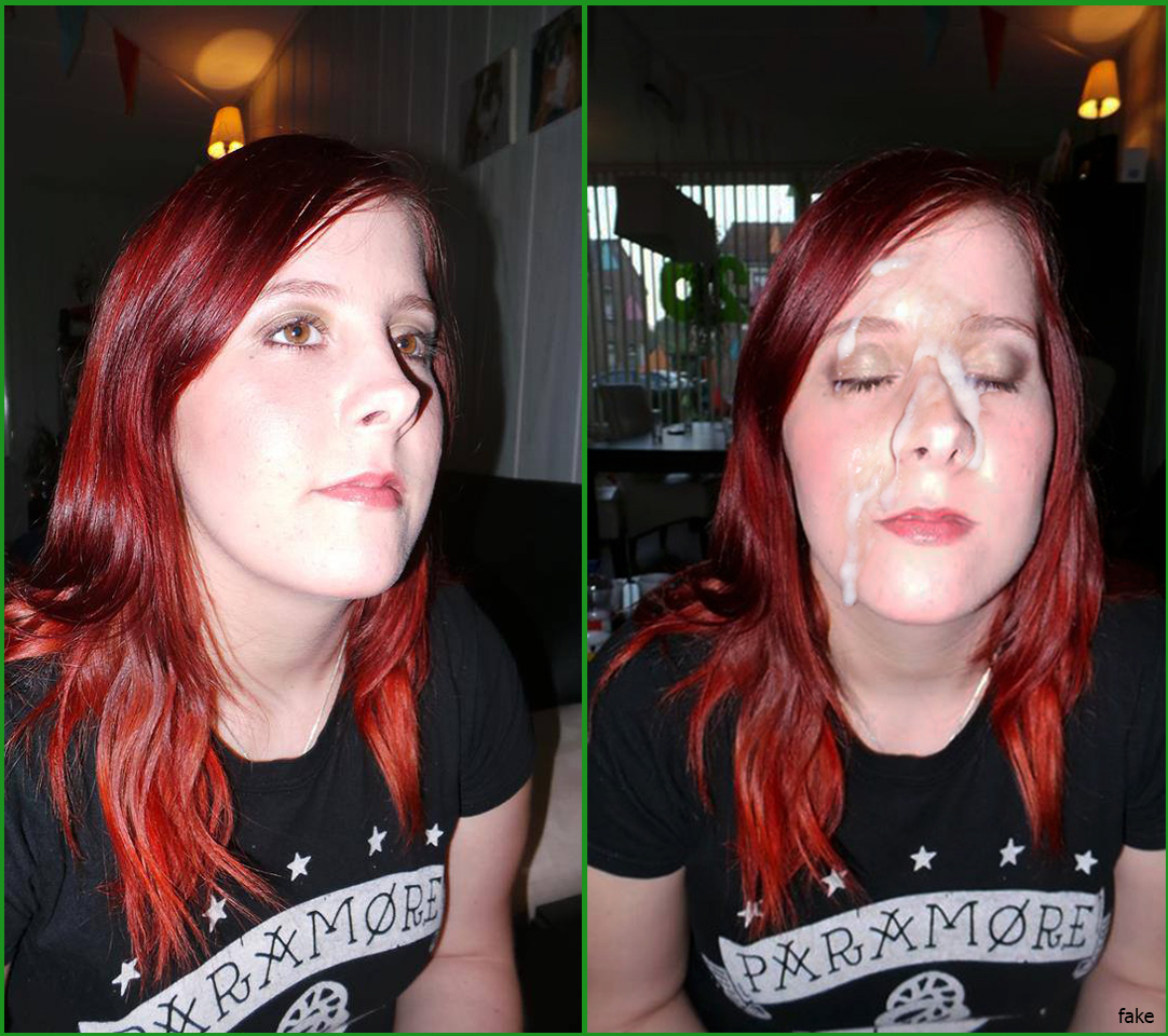 Before/After Facial pic