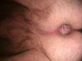 My ass hole
