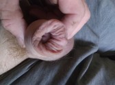 foreskin